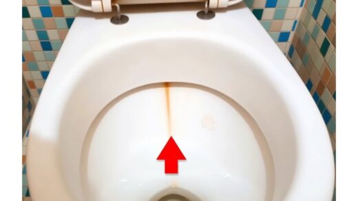 nesudėtingas kalkių ir rūdžių pašalinimas iš tualeto