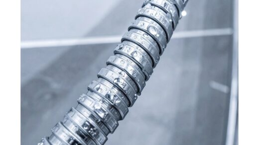 ant žarnos nėra kalkių nuosėdų