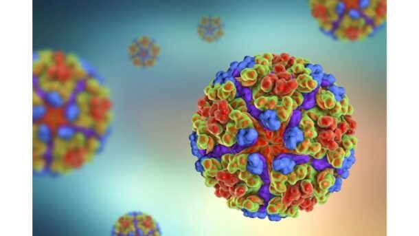 tropinė liga, sukelianti stiprų skausmą